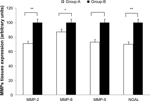 Figure 1 Western blot evaluation of MMPs and NGAL expression in wound tissues taken at the time of surgery in patients with CVUs treated (Group A) or not (Group B) with sulodexide at T1 and T2 of the study.Notes: Data are expressed as arbitrary units, where the higher value has been considered equal to 100. *P<0.05; **P<0.01.Abbreviations: CVU, chronic venous ulceration; NGAL, neutrophil gelatinase-associated lipocalin; MMP, matrix metalloprotease.