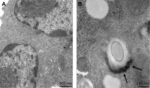 Figure 7 TEM images of FITC-LCP not taken up (A) and intracellular uptake in A549 cells (B). Magnification ×20,000.Note: Arrows point at microfilaments.Abbreviations: FITC, fluorescein isothiocyanate; LCP, lipid-coated hollow calcium phosphate; TEM, transmission electron microscopy.