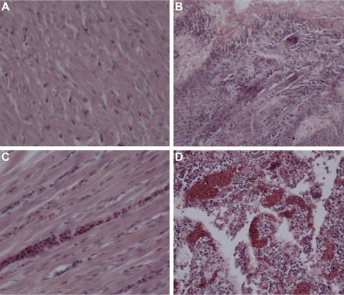 Figure 10 Histopathological analyses of the duodena and myocardia of chickens challenged with the highly virulent NDV strain F48E9.Notes: (A) Tissues of the duodena from chickens immunized with pFDNA-LDH@SiO2-NPs IN. (B) Tissues of the myocardia from chickens immunized with pFDNA-LDH@SiO2-NPs IN. (C) Tissues of the duodena from chickens immunized with pFDNA-LDH@SiO2-NPs IM, naked plasmid pVAX1-F(o) DNA IM, or PBS IM. (D) Tissues of the myocardia from chickens in groups immunized with the pFDNA-LDH@SiO2-NPs IM, naked plasmid pVAX1-F(o) DNA IM, or PBS IM.Abbreviations: IM, intramuscularly; IN, intranasally; LDH, layered double hydroxide; NDV, Newcastle disease virus; NPs, nanoparticles; PBS, phosphate-buffered saline; pFDNA-LDH@SiO2-NPs, NDV F gene encapsulated in the LDH@SiO2-NPs.