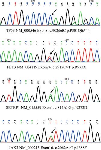 Figure 4 Sanger sequencing of genomic PCR products of bone marrow mononuclear cells. The detailed information of 4 genetic mutations, including TP53, FLT3, SETBP1, and JAK3, was written below the corresponding peak diagram. The black arrow pointed to the mutant base. PCR, polymerase chain reaction.