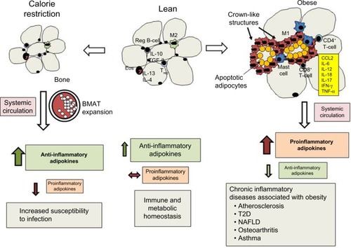Figure 1 Effects of calorie restriction and obesity on adipose tissue leukocyte populations, adipokine secretion, and chronic inflammation.