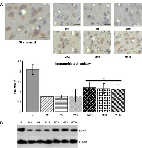 Figure 3 Assessment of BDNF.