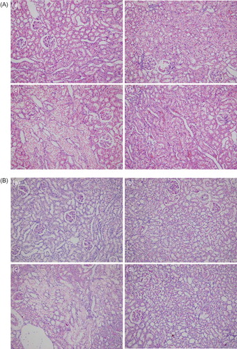 Figure 2. (A) Histopathological image of groups, using hematoxylin–eosin (HE). (a) Control, (b) GSPE alone, (c) AK, and (d) GSPE + AK. No pathological findings were noted in renal samples from GSPE and control groups. Kidney with normal appearance (HE ×200). AK: Extensive necrosis and desquamation noted in renal proximal tubular cells. Glomeruli are intact (HE ×200). AK + GSPE: AK + GSPE-treated rats showing prevention of AK-induced alterations. Only mild granulovacuolar changes are noted in renal proximal tubular epithelial cells (HE ×200). (B) Histopathological image of groups, using periodic acid Schiff (PAS). (a) Control, (b) GSPE alone, (c) AK, and (d) GSPE + AK. No pathological findings were noted in renal samples from GSPE and control groups. Kidney with normal appearance (PAS ×200). AK: Extensive necrosis and desquamation noted in renal proximal tubular cells. Glomeruli are intact (PAS ×200). AK + GSPE: AK + GSPE-treated rats showing prevention of AK-induced alterations (PAS ×200). (C) Histopathological image of groups, using Masson’s trichrome. (a) Control, (b) GSPE alone, (c) AK and (d) GSPE + AK. No pathological findings were noted in renal samples from GSPE and control groups. Kidney with normal appearance (Masson’s trichrome ×200). AK: Extensive necrosis and desquamation noted in renal proximal tubular cells. Glomeruli are intact (Masson’s trichrome ×200). AK + GSPE: AK + GSPE treated rats showing prevention of AK-induced alterations (Masson’s trichrome ×200).Note: AK, amikacin; GSPE, grape seed proanthocyanidin extract.