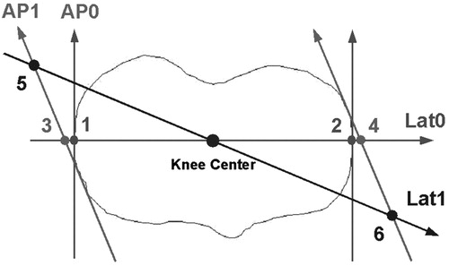 Figure 12. The registration errors of the knee center resulting from the image misalignment tend to cancel each other out. The lateral and medial tibial plateau edges registered with well-aligned AP and well-aligned lateral images are points 1 and 2; whereas they are points 3 and 4 if registered with misaligned AP and well-aligned lateral images, and they are points 5 and 6 if registered with misaligned AP and misaligned lateral images. However, the knee center (black sphere), which is defined as the center of the tibial plateau, i.e., the middle point of the lateral and medial tibial plateau edges, is approximately at the same position.