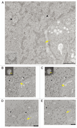 Figure 3 CLEM of a high pressure frozen, cryosubstituted and serially sectioned cell. (A) Anti-BMI1 immunogold labeling of heterochromatin structures (15 nm gold particles) of the same cell as in the Figure 2D, but a different thin section is shown in (A). The yellow arrow points to the nuclear region/domain that correlates with (the section of) the “PcG body” fluorescence seen in Figure 2B2 with the local density of heterochromatin structures being enriched in this domain. The heterochromatin structures are specifically enriched in the BMI1 immunogold label. Gold particles are sometimes situated towards the periphery of the heterochromatin structures (insert). (B–E) Four consecutive serial sections from the same area as shown in (A). In (B and C), the thin sections were first used for on-section immunofluorescence mapping of the BMI1 protein (inserts; note that the intensity of the “PcG body” in Fig. 3B is higher than that in Fig. 3C) to identify the position of the “PcG bodies”, and subsequently observed in the electron microscope (for a detailed analysis of the ultrastructural identification of the “PcG body”, see Sup. Figs. 3–5 in the Sup. Material). The two remaining serial thin sections (D and E) were on-section immunogold labeled for the BMI1 protein. Nucleolus (nu), cytoplasm (cy) and invaginagions of the nuclear envelope (black arrowheads) are designated in (A–E).