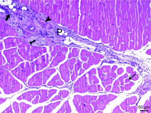 Figure 9 In cross-sections of muscle fibers of the micrograph of the ischemia reperfusion group, some cross-sectional faces take round shape (arrow) and mononuclear cell infiltration (thick arrow), vessel (arrowhead) and peripheral nerve sections (tailed arrow) are observed in the thickening perimysium (P) H&E ×200.