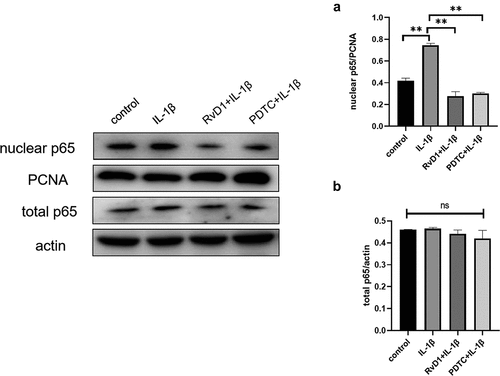 Figure 10. RvD1 inhibits the activation of NF‐κB signaling pathway in IL-1β induced chondrocytes. The results of western blotting of (a) nuclear p65 and (b) total p65. RvD1 and PDTC were shown to decrease the expression of nuclear p65. All experiments were repeated three times. **p < 0.01, ns indicates no significant difference.
