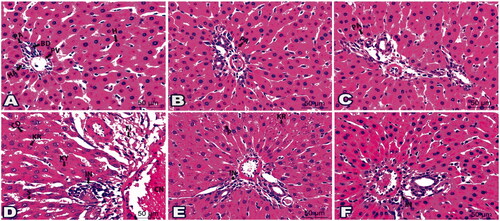 Figure 4. Photomicrographs of histological liver sections showed the validity of drug ‘4i’ in all tested groups: (A) Liver section from G1 demonstrated typical portal area (PA) enclosing portal vein (PV), hepatic artery (HA), and bile duct (BD). Notice hepatocyte (H) organised in cords. Histological liver sections from G4 (B) and G5 (C) displayed a picture looking like G1. (D) Liver section from G9 marked disarranged hepatic cords (CO), nuclear changes; karyorrhexis (KR) and karyolysis (KY), dilated sinusoids (S), aggregated inflammatory cells (IN) and fibres (Fi), in addition, congested blood vessel (CN). (E) Sections from liver-treated G12 restored better architecture except few hepatocytes seemed with karyorrhexis (KR) or pyknotic (P) nucleus. Notice inflammatory cells (IN). (F) Liver sections from G13 pointed only to mild inflammatory cells (IN). (H&E staining, 400x Magnification, Scale bar = 50 μm).
