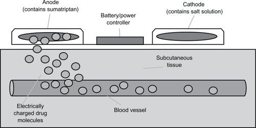 Figure 1 Principles of iontophoretic drug delivery systems.