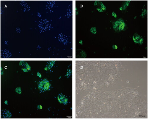 Figure 1. Identification and morphology of primary rumen epithelium cells (100 μm：100 ×). Note: (A) The nuclei were counterstained using DAPI. (B) Cytoplasm were counterstained using FITC-labelled CK18. (C) Merge of DAPI and CK18. (D) The morphology of primary rumen epithelium cell at 8 days of cultured. n = 3 RECs for each treatment.