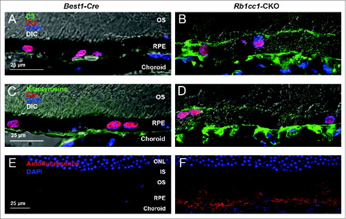 Figure 7. Subretinal inflammation and increased autofluorescence was detected in Rb1cc1-CKO mice. (A, B) Loss of autophagy activation resulted in increased deposition of C3 (complement component 3) and (C, D) oxidatively-damaged proteins on the basal surface of the RPE. There was also increased accumulation of autofluorescent puncta within the RPE (E, F). Photomicrographs are of sections taken from 8-mo-old mice. In all cases, abnormalities were only seen in the Rb1cc1-CKO mouse, and not in the Best1-Cre mouse, even in areas of Cre expression. IS, inner segment; ONL, outer nuclear layer; OS, outer segment; RPE, retinal pigment epithelium.