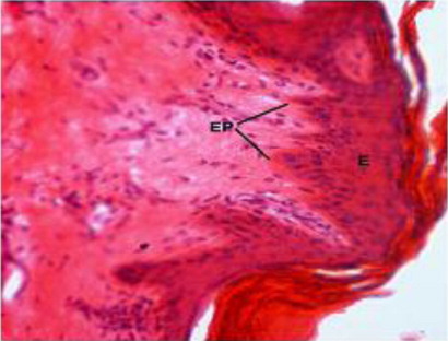 Figure 6. Thick epidermis (E) and typical epidermal pegs (EP) in thorax ventral region in H&E X 100.