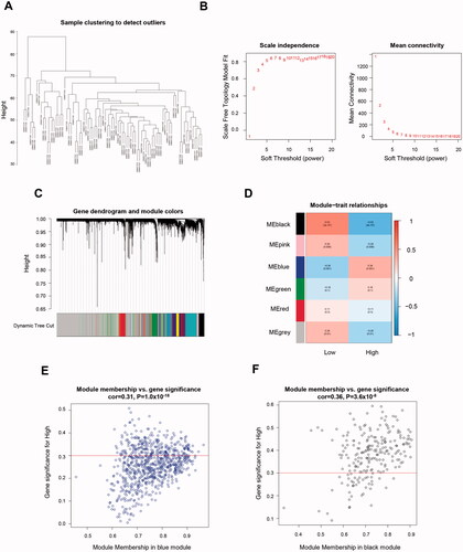 Figure 1. Identification of genes related to TNBC-specific glucose metabolism. (A) Sample clustering to detect outliers. (B) Determination of soft threshold by evaluating the scale-free topology fit index (left) and mean connectivity (right). (C) Dendrogram plot with colour annotation. (D) Heatmap for the correlations of gene modules to SUV. Correlations between module membership and gene significance values were presented in scatterplots for the blue (E) and black (F) gene modules. TNBC: Triple-negative breast cancer; SUV: standardised uptake value.
