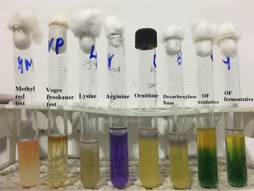Figure 3 Biochemical test results of Chromobacterium violaceum.