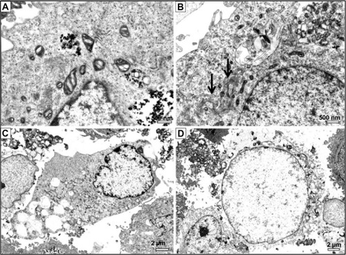 Figure 3 Ultrastructural features of osteoblasts incubated with 100 μg/mL titanium oxide nanoparticles (TiO2NPs) for 48 hours.Notes: (A) Intensive cytotoxic vacuolization of mitochondria. (B) Autophagolysosomes with remnants of organelles. Arrow indicates well-developed Golgi apparatus. (C) Vacuolization of cytoplasm. (D) Cell undergoing necrosis showing disintegration of cytoplasmic membrane and electron-lucent nuclear chromatin.