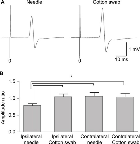 Figure 5 Motor evoked potentials (MEPs) during the needle and cotton swab conditions in experiment 2. Transcranial magnetic stimulation was applied to the hot spot of the primary motor cortex and MEPs were recorded from the contralateral first dorsal interosseous muscle. (A) Representative waveforms of the hand muscles during observation of the needle and cotton swab conditions. Note that the amplitude in the needle condition is smaller than that in the cotton swab condition. (B) Normalized amplitude (ratio of baseline) of MEPs of hand muscles during observation of ipsilateral needle, ipsilateral cotton swab, contralateral needle, and contralateral cotton swab conditions. Error bars indicate standard error of mean. Asterisk (*) indicates significant differences by post hoc comparison (p<0.05). MEPs were suppressed by the needle condition of the hand ipsilateral to the recorded muscle, but not the other conditions.