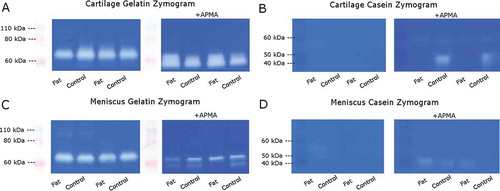 Figure 4. Representative zymograms. Scanned sections of (A,C) gelatin and (B,D) casein zymograms of (A,B) cartilage and (C,D) meniscus conditioned media samples.