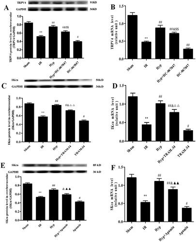 Figure 5. Effect of Hyp on the expression of TRPV4, IKCa and SKCa. The protein and mRNA expression of TRPV4 (A, B), IKCa (C, D) and SKCa (E, F) were detected by western blot and qPCR assays in the CBA of each rat group (n = 3). **p < 0.01 vs. sham; #p < 0.05, ##p < 0.01 vs. IR; &p < 0.05 vs. Hyp; $$p < 0.01 vs. HC-067047, △△p < 0.01 vs. TRAM-34; ▲▲p < 0.01 vs. apamin.