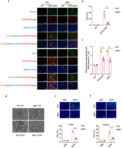 Figure 6. Mlkl deficiency causes a reduction of S. pluranimalium-triggered extracellular trap formation. LPS-primed WT and Mlkl-/- BMDMs were stimulated with S. pluranimalium strain STP1 (MOI = 25, 100 min). (A) representative immunofluorescence staining of METs formation as indicated by DNA decorated with histone or MPO within the ETs structures. Histone (green), MPO (green) and DNA (orange/blue). magnification, × 400. (B) METs were quantified by Fiji and presented as the percentage of ETs. (C) quantification of bacteria-induced METs formation using SYTOX green. Zymosan (1 mg/ml) stimulated cells were used as positive control. (D) the METs release was detected by SEM. Age- and sex-matched WT and Mlkl-/- mice were infected intranasally (1 × 109 CFUs) or i.V. (1 × 108 CFUs) with S. pluranimalium strain STP1 for 24 h. (E, F) representative immunofluorescence staining of histone was performed in lung and kidney sections, and ETs were quantified by Fiji and presented as the percentage of ETs. Graphs are means ± SD from data pooled six (B, C, E and F) biological replicates. Statistical significance is indicated by *p < 0.05, **p < 0.01.