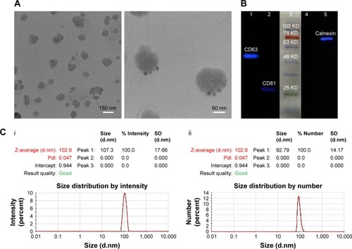 Figure 2 Characterization of exosomal particles.Notes: (A) Transmission electron micrograph of negatively stained exosomes with a diameter of 30–150 nm, labeled for CD63 (Low magnification, 13,000×, scale bar =150 nm, and high magnification, 40,000×, scale bar =60 nm). (B) Western blot analysis of positive and negative exosomal CD markers in both isolated exosomes and cellular lysate: (1) CD63 expression in exosomes lysate, (2) CD81 expression in exosomes lysate, (3) protein marker, (4) non-expression of calnexin in exosomes lysate, (5) the existence of calnexin in the cell lysate. (C) Size distribution by intensity (i) and size distribution by number of MSCs-Exo (ii).Abbreviations: CD, cluster of differentiation; MSCs-Exo, mesenchymal stem cells-derived exosomes; Pdi, polydispersity index.