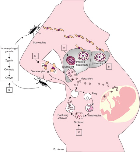 Figure 1. Malaria life cycle and antimalarial drug Plasmodium stage targets. Plasmodium sporozoites travel from the salivary glands of the anopheline mosquito through the bloodstream of the human host to the liver, where they invade hepatocytes and divide to form multinucleated schizonts. Hypnozoites can be found in P. vivax and P. ovale infections as a quiescent stage in the liver. Liver schizonts rupture and release merozoites into the circulation, where they invade red blood cells. Within the red cells, merozoites mature from ring forms to trophozoites to multinucleated schizonts. Some merozoites differentiate into male or female gametocytes that can then be ingested by the anopheline mosquito. The Plasmodium cycle is completed in the mosquito gut. Capital letters indicate the Plasmodium-stage targets of antimalarial drugs.