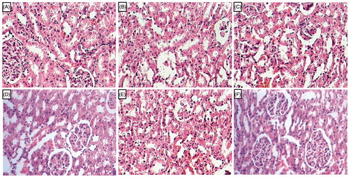 Figure 3. Effect of l-arginine on alteration in kidney histology in EG-induced urolithiasis in uninephrectomized rats. Photomicrograph of sections of kidney of normal (A), urolithiasis control rats (B), Telmisartan (10 mg/kg) treated rats (C), Cystone (500 mg/kg) treated rats (D), l-arginine (500 mg/kg) treated rats (E), and l-arginine (1000 mg/kg)-treated rats (F). H & E staining at 100 × .