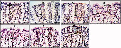 Figure 5. Olmesartan medoxomil self-microemulsifying drug delivery system (OMS) nanoformulation improves the damage of epithelial barrier in trinitrobenzene sulfonic acid (TNBS)-induced acute colitis in rats. Photomicrographs of colonic sections showing immunoexpression of E-cadherin in the surface epithelium (white arrows) and underlying lamina connective tissue cells (black arrows) (× 20): (A) Normal control group showed strong E-cadherin expression, (B) TNBS-colitic (Positive control) group showed reduced E-cadherin expression with damaged surface epithelium. (C) Sulfasalazine and (G) Olmesartan medoxomil self-microemulsifying drug delivery system high dose groups showed marked improvement with preservation of E-cadherin expression. (D) Olmesartan medoxomil low dose group revealed slight preservation of E-cadherin expression. (E) Olmesartan medoxomil high dose and (F) Olmesartan medoxomil self-microemulsifying drug delivery system low dose groups showed moderate preservation of E-cadherin expression.