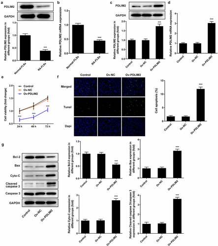 Figure 1. The expression of PDLIM2 was decreased in HFLSs-RA, and overexpression of PDLIM2 inhibited excessive proliferation and induced apoptosis in HFLSs-RA. A. Western blot were used to detect the expression of PDLIM2 in HFLSs-RA. B. The expression of PDLIM2 in HFLSs-RA were detected by RT-qPCR. ***p < 0.001 vs Normal-FLSs. C. Western blot detected the expression of PDLIM2 after transfection. D. RT-qPCR detected the expression of PDLIM2 after transfection. E. CCK-8 was used to detect the cell viability after transfection. F. Tunel assay was used to detect the apoptosis of HFLSs-RA after transfection. G. The expression of apoptosis-related proteins were detected by western blot. ***p < 0.001 vs Ov-NC.