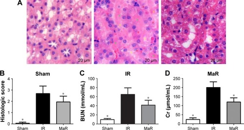 Figure 1 MaR1 alleviated renal injury.