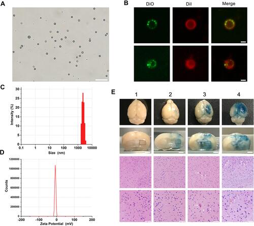 Figure 4 BBB-opening experiment in vivo.