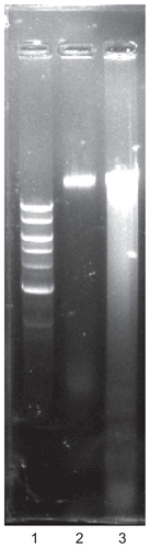 Figure 4 DNA fragmentation assay. Lane 1 (1 kb ladder), lane 2 (10% serum), and lane 3 (treated with silver nanoparticles).
