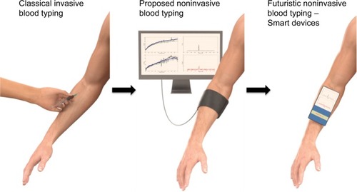 Figure 11 Optical biosensor past, present, and futuristic development for noninvasive blood typing.