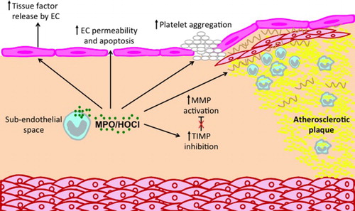 Figure 2. Potential roles of MPO and MPO-derived oxidants in promoting atherosclerotic plaque instability. MPO can affect a number of processes that contribute to plaque instability and possible plaque rupture. MPO released by monocyte/macrophages and neutrophil can activate MMPs and inhibit TIMPs, leading to reduction in ECM, especially in the fibrous cap. In addition, MPO may contribute to a thrombogenic environment by inducing endothelial cells to release tissue factor and by priming of platelet aggregation. Finally, MPO can increase endothelial cell (EC) permeability and apoptosis, thereby increasing the leakiness of the endothelium.