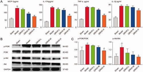 Figure 7. QRHX inhibits PI3K/Akt signal pathway and down-regulates the level of inflammatory cytokines. (A) Inflammatory factor levels of MCP-1, IL-17A, TNF-α and IL-1β. (B) Protein expression levels of p-PI3K, PI3K, p-Akt and Akt. (C) Quantitative analysis of p-PI3K, PI3K, p-Akt and Akt using ImageJ software. Data were expressed as mean ± SEM. **p < 0.01 vs. Normal group, #p < 0.05 and ##p < 0.01 vs. Model group.
