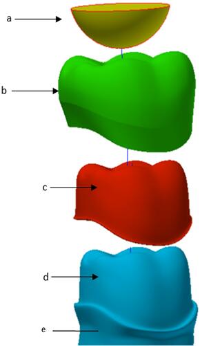 Figure 3 Materials of FEA model; (A) indenter/opposing tooth of enamel (B) crown (C) cement (D) abutment/Dentine (E) root.