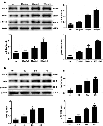 Figure 3. AGE treatment activates ROCK and the NF-κB signalling pathway in HPCs. (a) Detection of ROCK, p-IκBα, p-NF-κB after treatment with increasing concentrations of AGE for 48 h. (b) Detection of ROCK, p-IκBα, and p-NF-κB after exposure to 100 μg/ml AGE over time. (Data are the mean ± S.D.; *P < 0.05 vs control, n = 3)