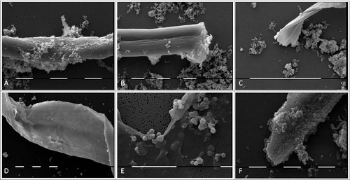 Figure 4. SEM of L-form cells from blood isolate No1 grown in semisolid agar during the second phase/week of cultivation. (A) Cluster of granular forms; (B, C, F) groups of polymorphic granular, oval, rod and elongated filamentous forms; (D, E) typical coccoid and large spherical L-form bodies of different size. Bars: 10 μm (A, B,C, D, E); 1 μm (F).