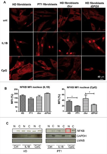 Figure 5. NFKb pathway. (A) Anti-NFKB (red) immunofluorescence in fibroblasts (HD, PT1, iScr and iEPG5) untreated and stimulated with IL1B or CpG. Graphs show mean fluorescence intensity (MFI) of NFKB in the nucleus after IL1B or CpG treatment. Error bars are shown as SEM. (B) Western blot analysis of NFKB performed on untreated and treated fibroblast nuclear/cytoplasm extracts. GAPDH was used as a cytoplasm purification control and LMNB (lamin B) as a nuclear purification control.