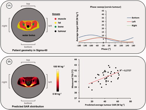 Figure 3. (A) Result of a mimicked clinical phase sweep optimization procedure, for heating with the Sigma-60 applicator. (B) Predicted SAR distribution for the optimized phase settings and an example of the correlation between predicted average SAR and measured T50 tumor temperatures for cervical cancer patients treated at institute A with the Sigma-60 applicator. The green contour in the SAR distribution indicates the target region.