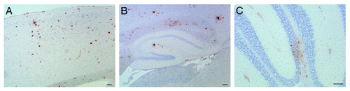 Figure 1. Amyloid deposition in APP YAC x Psen1-L166P mice. Sections of a 20-mo-old APP YAC x Psen1-L166P (+/+) mouse showing parenchymal amyloid deposition in the cerebral cortex (A), the hippocampus (B) and the cerebellum (C). Amyloid deposition was also observed in cerebral vessels and in pial (leptomeningeal) vessels. Immunohistochemistry using antibody 4G8 was performed as described (12). Scale bars = μ100.