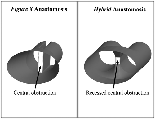 Figure 2. Idealized Figure 8 and Hybrid anastomosis geometries.