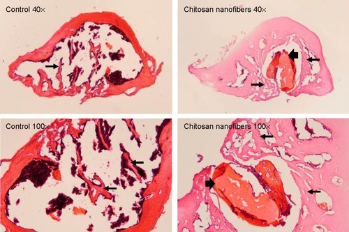 Figure 6 Effects of chitosan nanofiber scaffolds on bone healing using bone histomorphometry.Notes: Bone defects were surgically created in the proximal femurs of male C57LB/L mice, and chitosan nanofibers were implanted into one defect for 21 days. After that period, animals were sacrificed, and the femurs were collected for a histological analysis. After removing the muscle and connective tissues, the femurs were decalcified, fixed, embedded in paraffin, and then sliced. These specimens were stained with hematoxylin and eosin. The stained signals were observed and photographed under a light microscope. Thin arrows indicate new bone areas, and thick arrows designate areas where the scaffolds were located. Only one defect was created in each proximal femur of an animal, and totally nine animals were treated in this study.