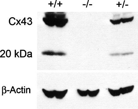 Figure 4 Cells derived from Cx43 knock-out mice do not produce either the full-length or 20-kDa Cx43-immunoreactive proteins. Western blot analysis was performed for Cx43-immunoreactive proteins expressed in bone marrow–derived macrophages. Cells were harvested from newborn mice that were either wild-type (+/+), heterozygous (+/–) or homozygous-null (–/–) for the Cx43 gene. After 7 days in culture the cells were treated with 1 μ g/mL lipopolysaccharide. After 24 hours, cells were lysed and Cx43 was analyzed by immunoblotting. Notice the parallel decrease in the density of the 43-kDa and the 20-kDa band in the cells from the heterozygote animal and the absence of both bands in cells obtained from the Cx43-null animal. These results further support the notion that the 20-kDa band is the product of the Cx43 gene.