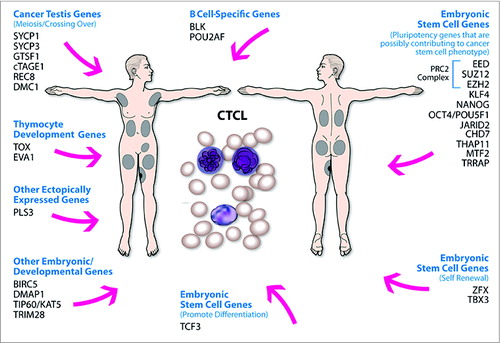 Figure 5. Summary of different classes of aberrantly expressed genes in CTCL. Aberrant expression of embryonic stem cells genes, cancer testis genes, B cell-specific genes and thymocyte development genes may play a role in tumorigenesis/cancer progression in CTCL. Specifically, while embryonic stem cell genes (e.g., members of the PRC2 complex) may be reprogramming cancer stem cell phenotype, cancer testis genes may be contributing to aneuploidy and genomic instability by producing aberrant chromosomal translocations.