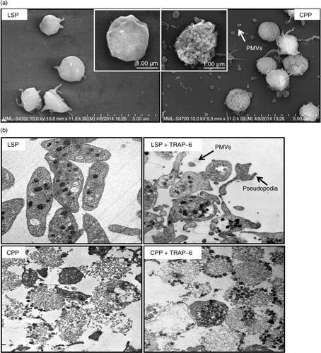 Fig. 1.  CPPs exhibited distinct membrane changes by field emission scanning electron microscopy (FESEM) analysis, disturbance of intracellular organization and lack of activation response observed by transmission electron microscopy (TEM). (a) FESEM analysis of liquid-stored platelets (LSPs) and cryopreserved platelets (CPPs). (b) TEM of resting and thrombin receptor activating peptide (TRAP-6, 20 µM) activated liquid-stored PLTs (LSPs) and cryopreserved PLTs (CPPs).