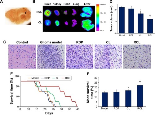 Figure 7 Effect of RCL on intracranial glioma model mice. (A) Brain slices of glioma model mice. Black arrow points to glioma tissues. (B) Tissue imaging of glioma-bearing mice treated with 20 mg/kg CL and RCL, respectively. (C) Representative images of HE staining of mice brain sections (×400). (D) Tumor volume. Data are represented as mean ± SD (n = 4–6 for each group). *p < 0.05 and **p < 0.01 compared with the glioma of model mice. (E) Survival curve and (F) mean survival time of the glioma-bearing mice treated with the liposomes (n = 8–10 for each group). *p < 0.05 and **p < 0.01 compared with the model mice.Abbreviations: CL, curcumin liposome; RCL, RDP-modified curcumin nanoliposomes; RDP, RVG-derived peptide; HE, hematoxylin-eosin staining.