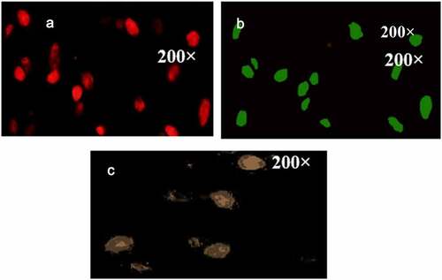 Figure 3. Cell fluorescence double staining observation. (A: Dil-acLDL staining; B: FITC-UEA-I staining; C: double staining).