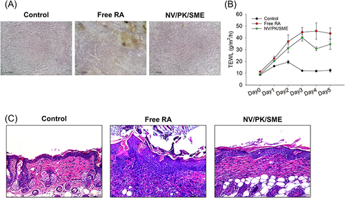 Figure 6 The in vivo skin tolerance of the liposomes in the healthy mouse: (A) the appearance of mouse skin surface; (B) the TEWL level of the mouse skin; and (C) the H&E-stained histology of mouse skin treated by liposomes. All data are presented as the mean of five experiments±S.E.M.