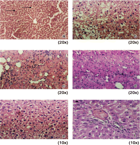 Figure 3.  Histology of liver in control and experimental animals. (A) Control rats showing normal architecture. (B) DEN induced rats showing loss of architecture (both nuclear size and shape vary). (C) DEN + RC (250 mg) treated rats showing anaplastic tumor cells with scanty Cytoplasm. (D) DEN + RC (500 mg) treated rats showing scanty strands of tumor cells surrounded by large amount of neutrophils. (E) DEN + RC (750 mg) treated rats showing scanty strands of tumor cells surrounded by large amount of neutrophils. (F) RC alone (500 mg) treated rats showing normal morphology.