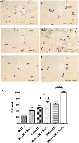 Figure 2. Detection of ceroid in THP-1 macrophages. Some cells were pretreated with ferritin (100 µg protein/ml; 0.227 µM) for 24 h. The cells were then incubated for 24 h with or without native LDL (200 µg protein/ml), sphingomyelinase-modified LDL (200 µg protein/ml) or ferritin (100 µg protein/ml). They were then incubated for 7 days with medium containing 10% (v/v) lipoprotein-deficient serum with or without ferritin (100 µg protein/ml). The “soluble” lipids were removed with ethanol and xylene and the cells stained for ceroid with Oil Red O (A–F). These images are representative of three independent experiments. The levels of ceroid were quantified by ImageJ and presented as percentage ceroid compared with cells incubated with ferritin and SMase-LDL (G). The control cells (No LDL) were not exposed to ferritin or LDL. **p < 0.01 and ***p < 0.001 compared with the cells without LDL. ≠p < 0.05 and ≠≠≠p < 0.001 for the indicated comparison.